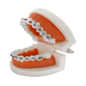 Gebits- demonstratiemodel small met beugel ( incl. kleine tandenborstel)