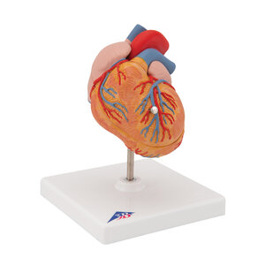 3B Klassiek Menselijk Hartmodel met Linker Ventriculaire Hypertrofie (LVH), 2-delig