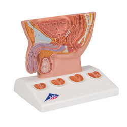 Urologie