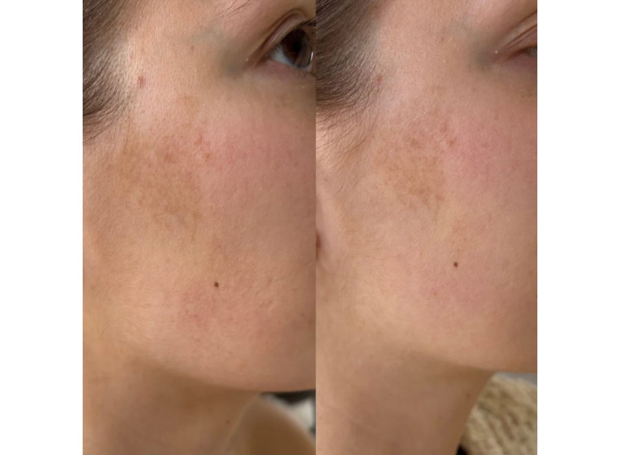 ray - anti-dark spot serum 30ml