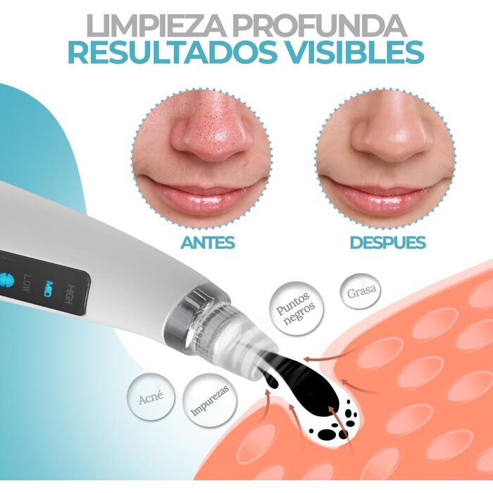 Kit Facial 4 Étapes Pro : Extracteur, Nettoyant Électrique - Jusqu'à 35% !