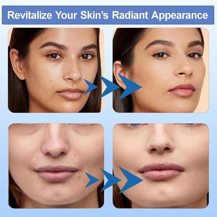 Stylo de Microneedling sans fil avec 9 cartouches - Jusqu'à 29% de réduction