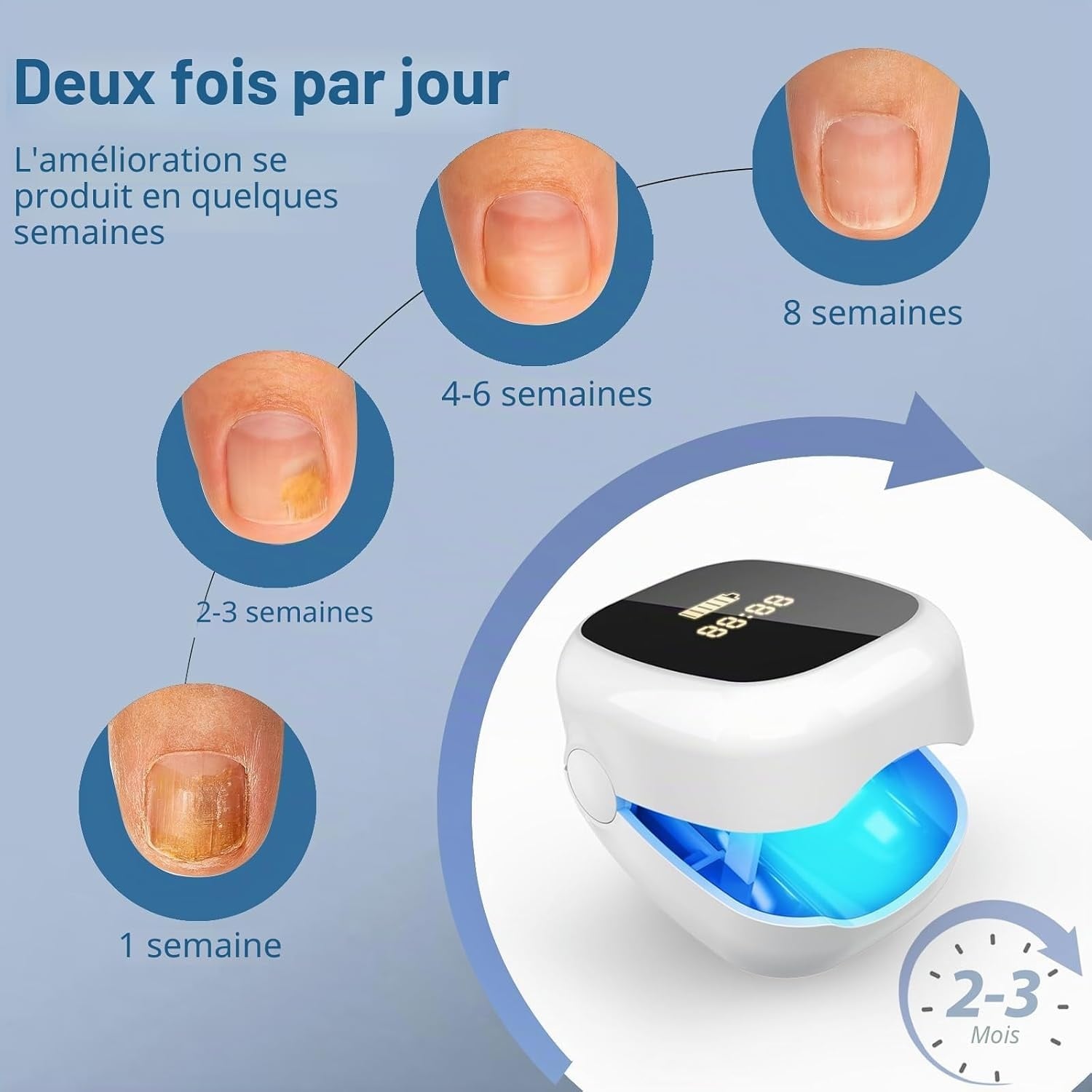 Appareil Laser Mycose Ongles - Lumière Bleue et Infrarouge - 31% de remise