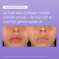 UltraCalming Stabilizing Repair Serum 50ml