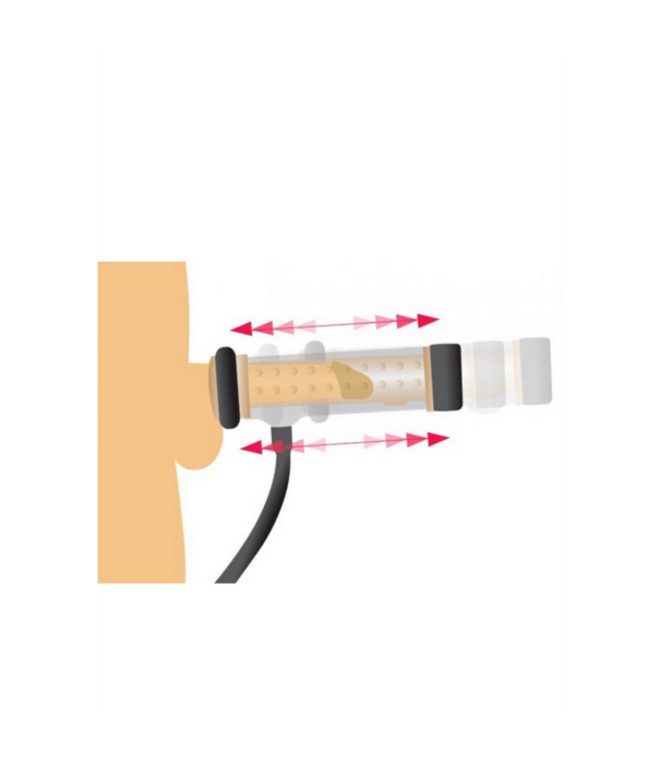 Textured Melker Cilinder