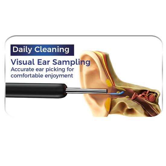 Nexxt NEXXT Ear Wizard Oorreiniger met Camera en Appfunctie - 720P