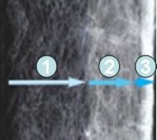 Dennerle Nano Clean Ersatzfilter Dennerle Nano Clean Ersatzfilter