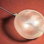 Needle trough balloon