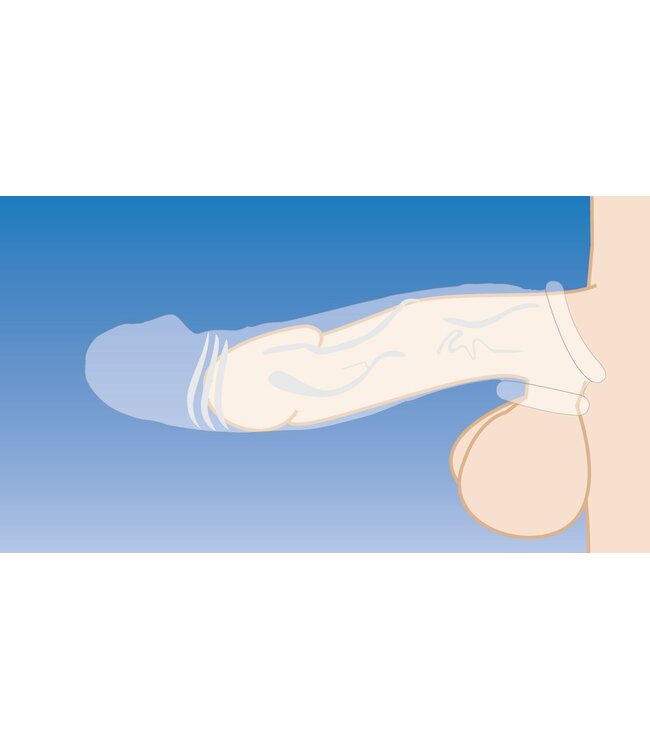 XR Brands Size Matters - Clear Extender Gebogen Penissleeve