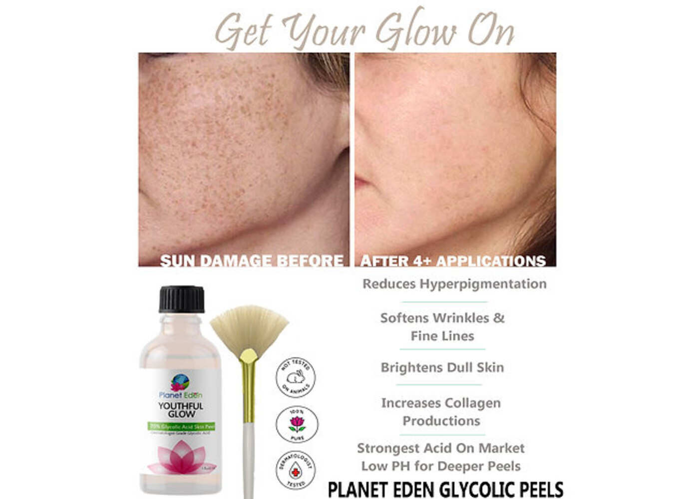 Glycolic acid peel