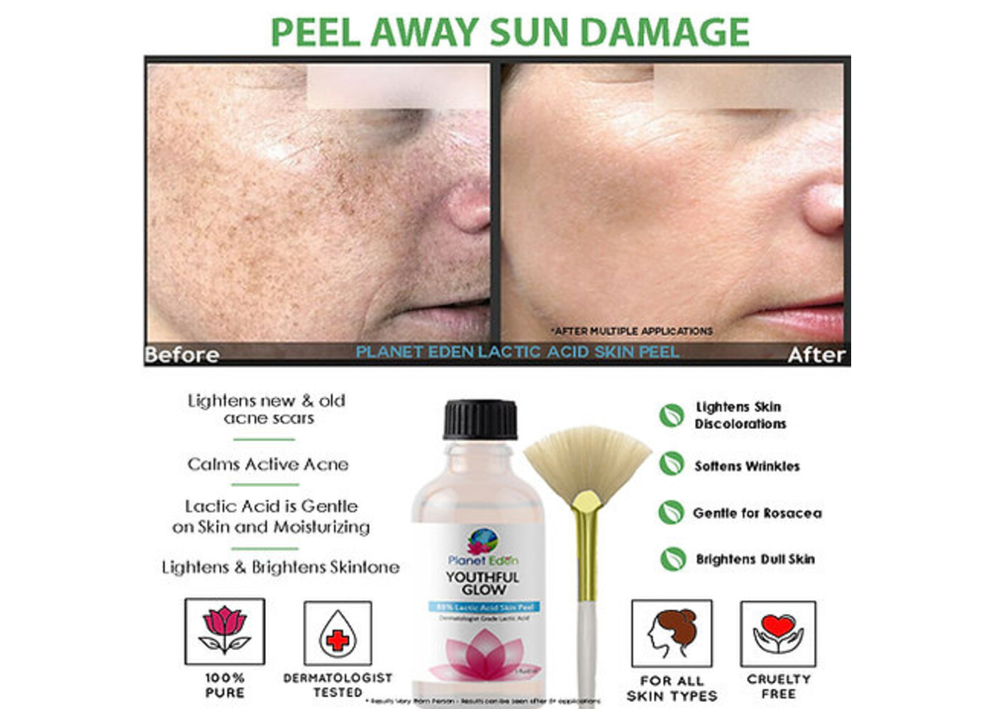 Lactic Acid peel