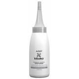 Kitoko Dandruff Scalp Lotion Kitoko Dandruff Scalp Lotion