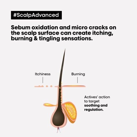 L'Oreal SE Scalp Advanced Anti-Discomfort Shampoo Refill -500ml