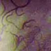 Nematodes Steinernema (5 million)