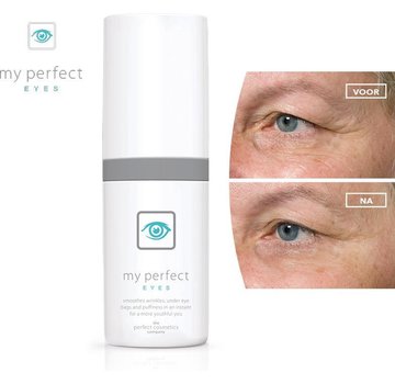 Bekend van TV My perfect Eyes - Weg met rimpels, wallen en donkere kringen Oogcrème - 10g