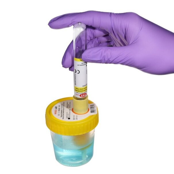 Urinebeker met Transferunit