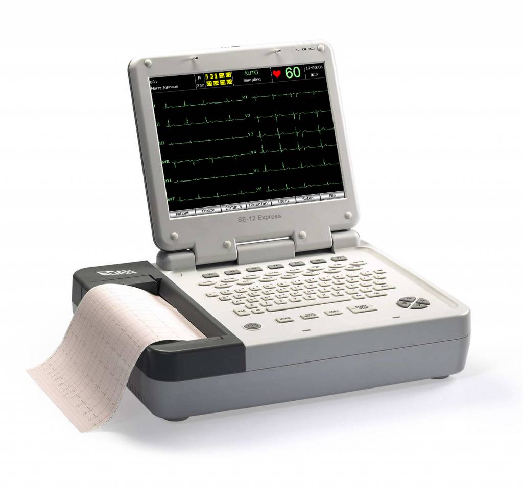 Stress Test ECG