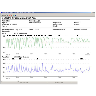 Nonin nVision Data Management Software -CD Rom