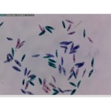 Dino-Lite Edge Digitales USB-Mikroskop AM7115MZT