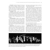 Plankton - A Guide to Their Ecology and Monitoring for Water Quality