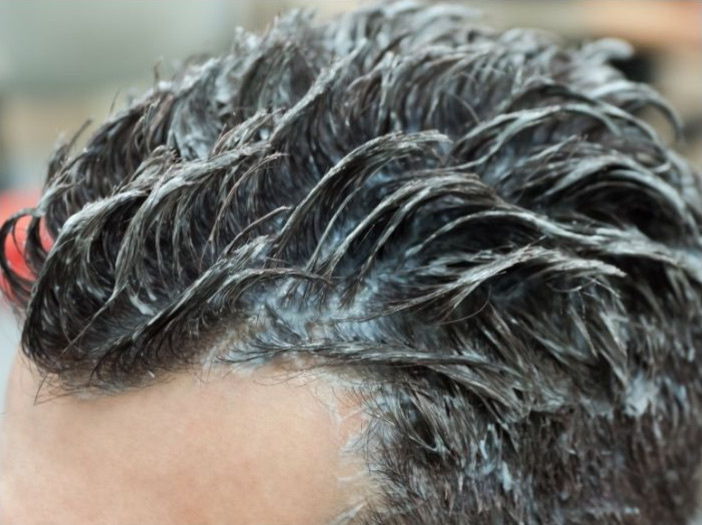 Anti-Schuppen Shampoo Männer