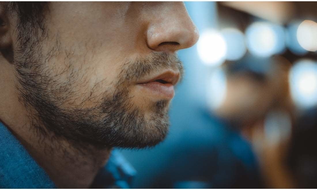 bald spots in your Beard