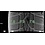 Mini Cooper / S / One / Cabrio F55 F56 F57 508 16 inch velgen Dunlop Runflat Winterbanden Origineel