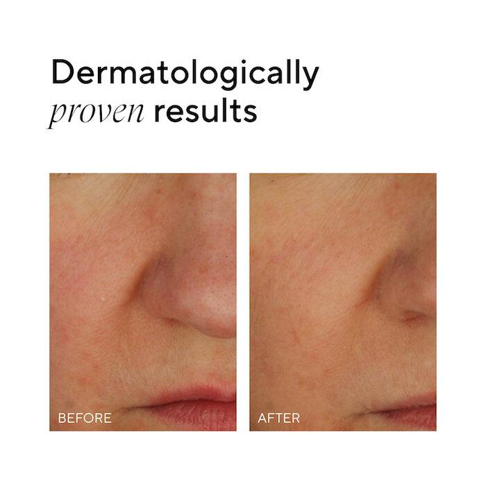 MÁDARA SOS+ Sensitive Moisturizer MÁDARA SOS+ Sensitive Moisturizer