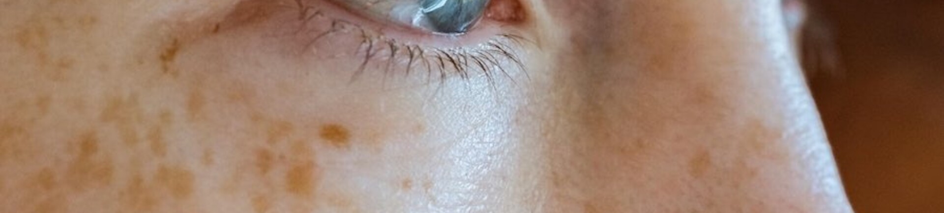 5 simpele tips om rimpels te verminderen