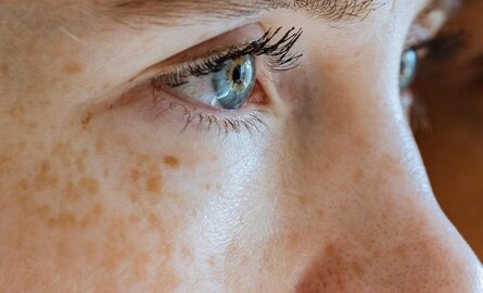 5 einfache Tipps zur Faltenreduzierung