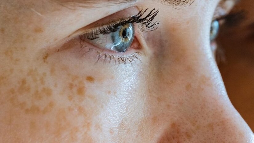 5 simple tips to reduce wrinkles