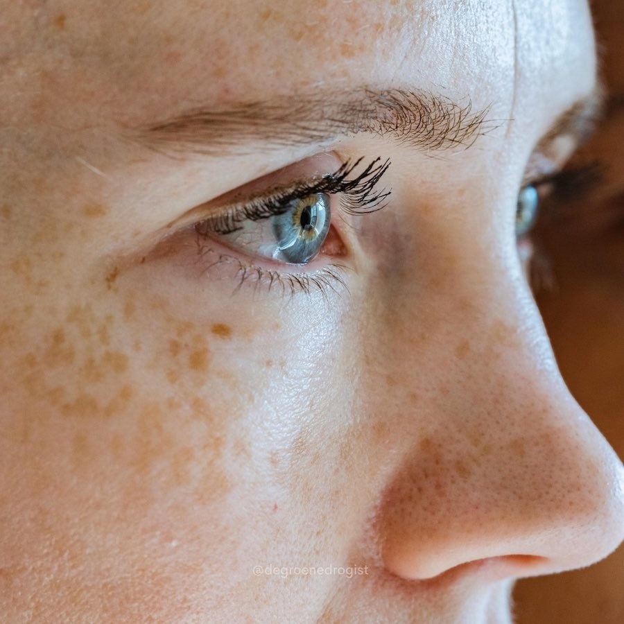 5 simple tips to reduce wrinkles 5 simple tips to reduce wrinkles