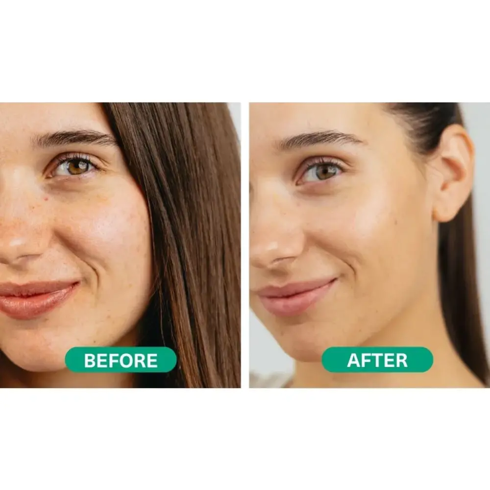 Hemptouch Skin Perfection Azelainsäure-Serum 10% Hemptouch Skin Perfection Azelainsäure-Serum 10%