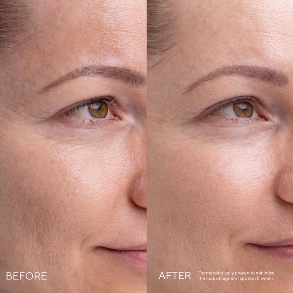 MÁDARA Kojic Alternative Pigment Serum MÁDARA Kojic Alternative Pigment Serum