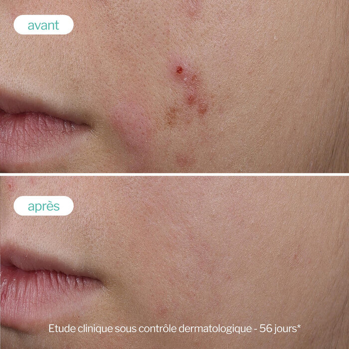 Novexpert Trio Zinc Booster Serum