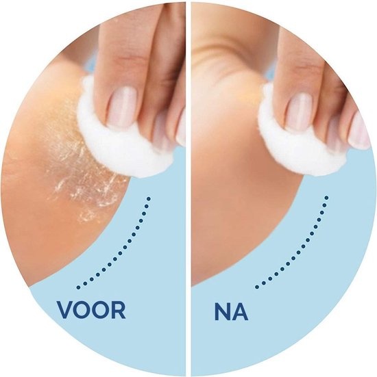 Scholl Velvet Smooth - Navulling Eeltverwijderaar - Extra Fijn - Voetvijl - 2 Stuks - Verpakking beschadigd