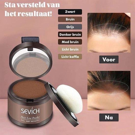Sevich Hair Building Fibers for Hairline and Crown - Medium Brown Hair Fibers - Onlinevoordeelshop Sevich Hair Building Fibers for Hairline and Crown - Medium Brown Hair Fibers - Onlinevoordeelshop
