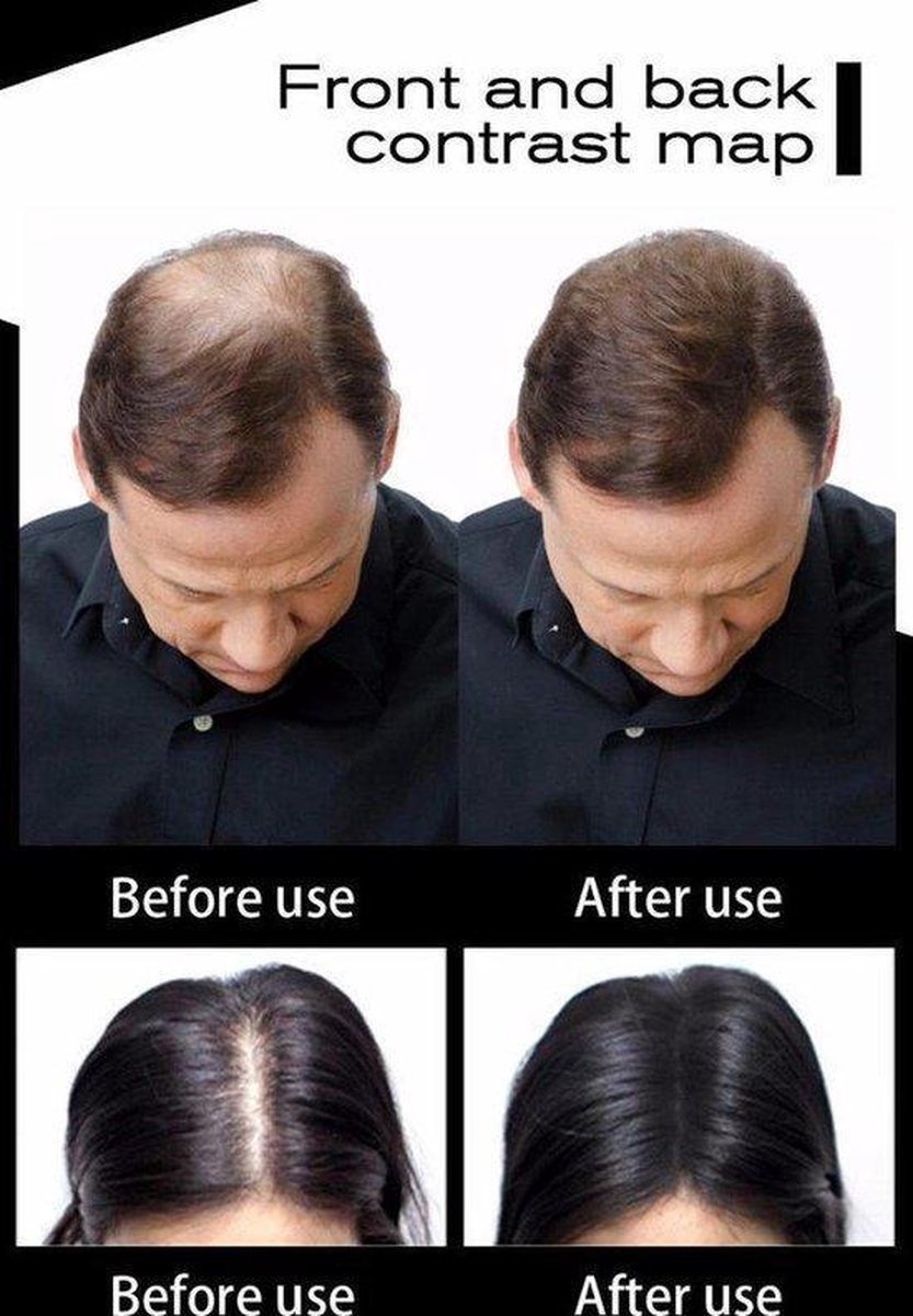Sevich Hair Building Fibers for Hairline and Crown - Medium Brown Hair Fibers - Onlinevoordeelshop Sevich Hair Building Fibers for Hairline and Crown - Medium Brown Hair Fibers - Onlinevoordeelshop