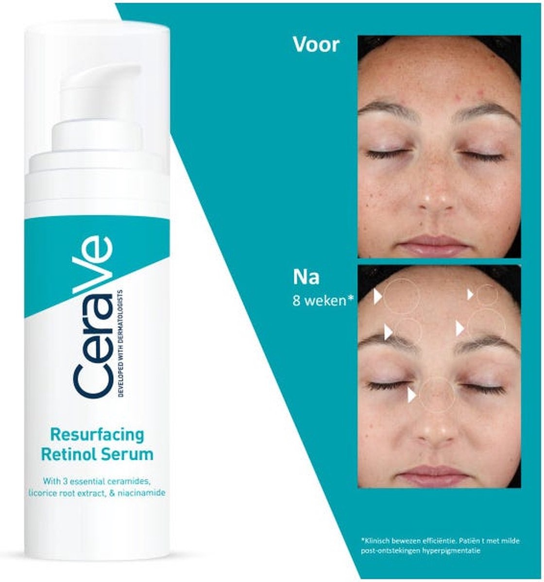 CeraVe Resurfacing Retinol Serum – gegen verbleibende Narben, Hautunreinheiten und sichtbare Poren – 30 ml