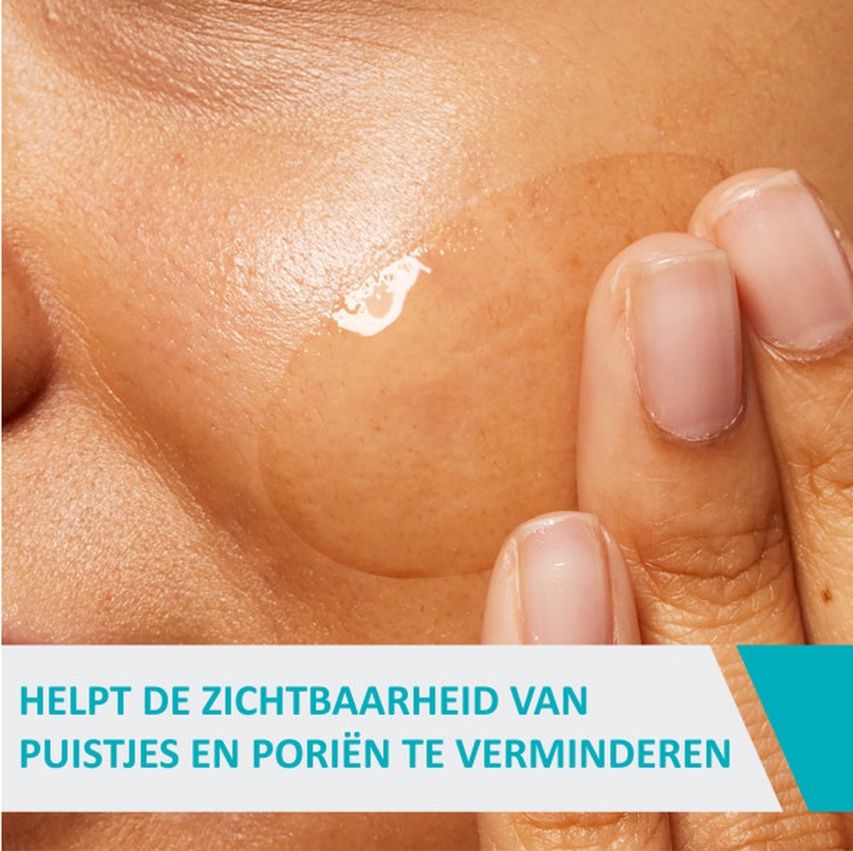 CeraVe Acne Control Gel - 40ml - voor onzuivere huid met neiging tot acne - Verpakking beschadigd