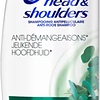 Head & Shoulders Itchy Scalp 2in1 - Shampoing et après-shampooing antipelliculaire - Jusqu'à 100 % sans pellicules - 270 ml