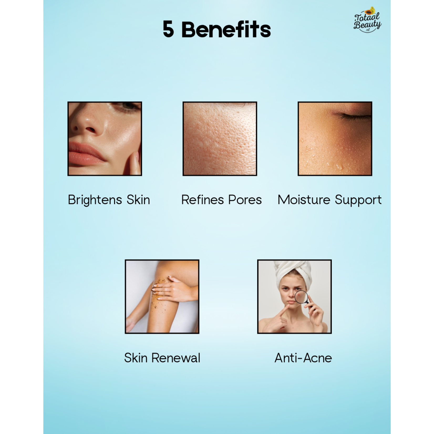 Kojie San, nummer één in anti-pigment producten! Kojie San Skin Lightening Pore Minimizing Toner – 100ml – Tegen Pigmentvlekken – Egale Huid – Porie Verfijnende Toner – Hydraterend & Verfrissend – Anti Acne – Kojic Acid Gezichtsverzorging