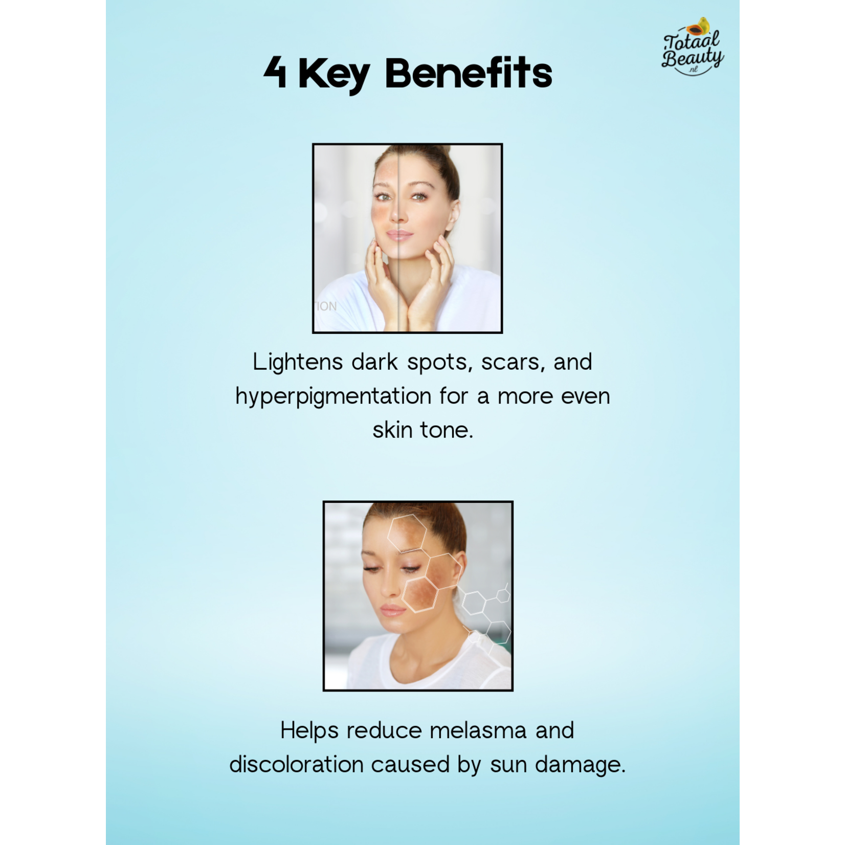 Kojie San, nummer één in anti-pigment producten! Savon éclaircissant Kojie San – 2 x 65 g – Anti-taches pigmentaires – Élimine les taches brunes – Peau uniforme – Savon blanchissant – Acide kojique – Nettoyant visage et corps – Anti-acné