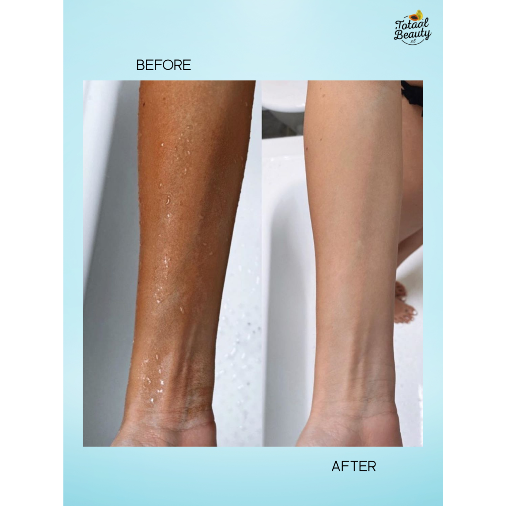 Kojie San, nummer één in anti-pigment producten! Kojie San Skin Lightening Body Lotion 100ml