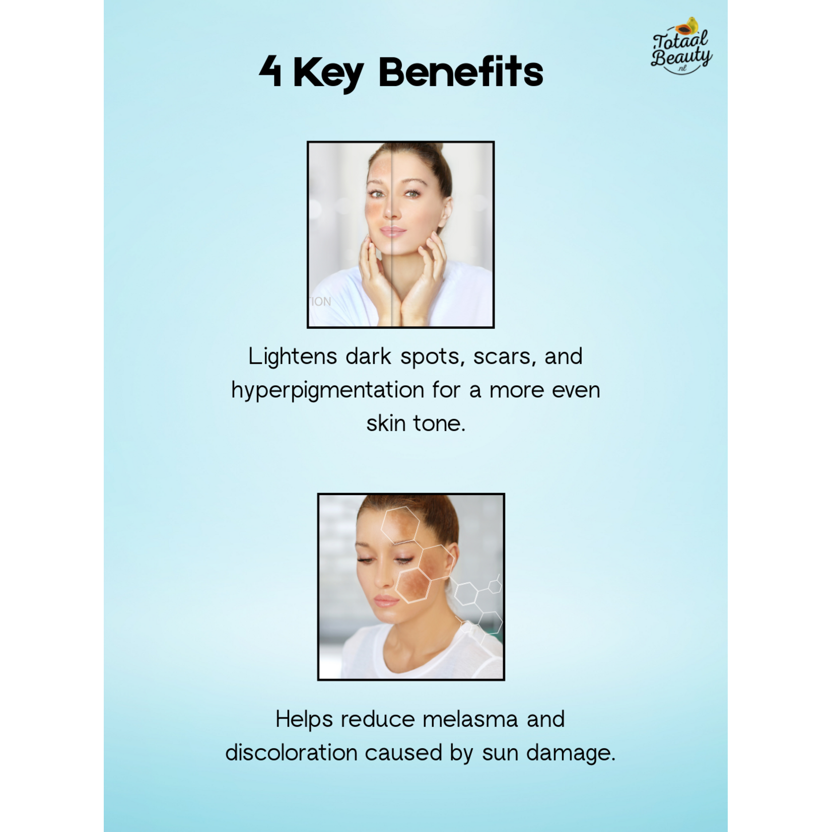 Kojie San, nummer één in anti-pigment producten! Kojie San Ultimate Radiance Bundel – Complete Skin Lightening Set – Tegen Pigmentvlekken – Donkere Vlekken Verwijderaar – Egale Huid – Whitening Gezichts- & Lichaamsverzorging – Hydraterend & Voedend – Anti Acne
