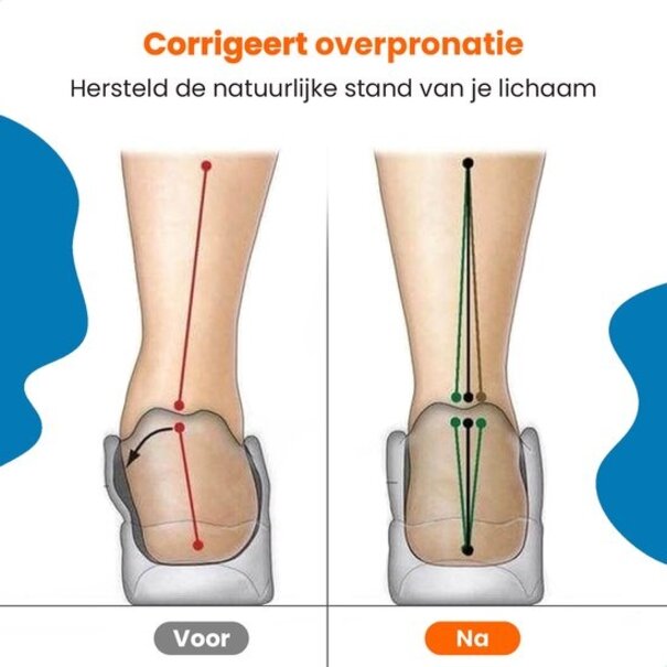 FootActive Steunzolen voor gevoelige voeten