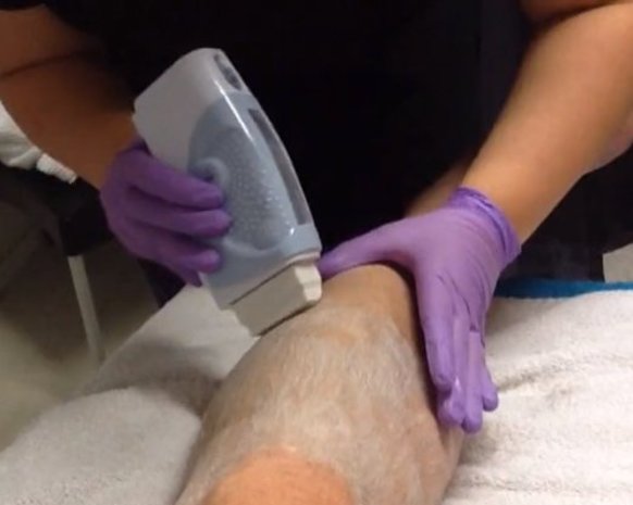 Holiday Body Waxing Expert training  excl startkit Holiday Body Waxing Expert training  excl startkit