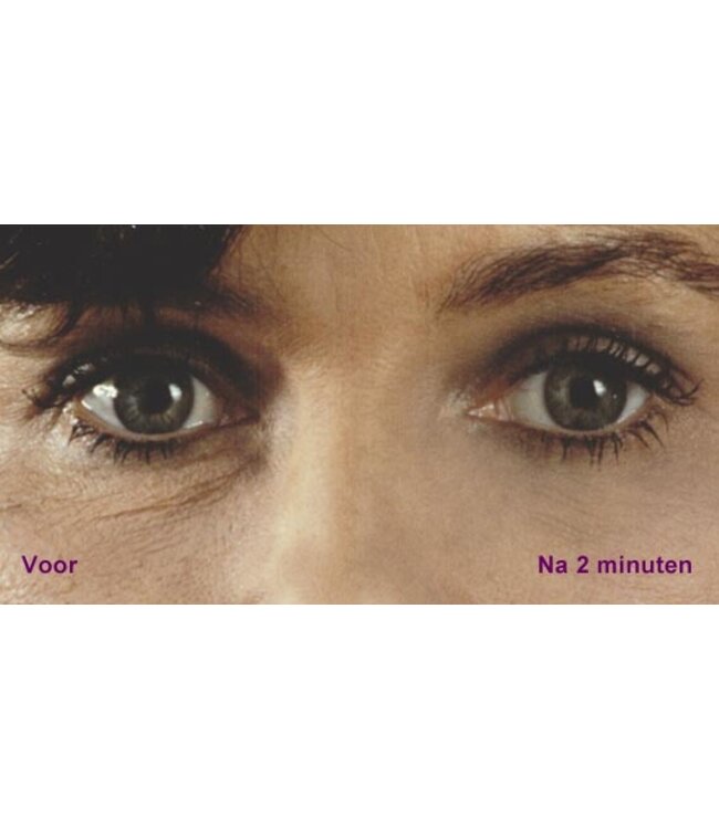 Supreme Direct Eyelift 6ml