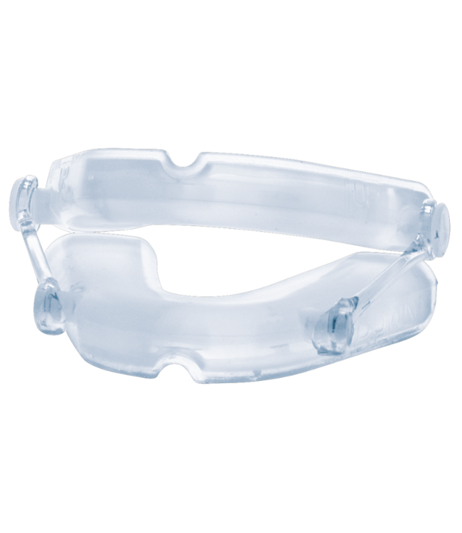 Maßgeschneidertes Oniris Anti-Schnarch-Mundstück (MRA).