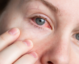 Rode ogen: hooikoorts, huisstofmijt of iets anders?